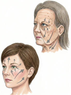 Lifting du milieu du visage Result — Dr. Bouraoui Kotti