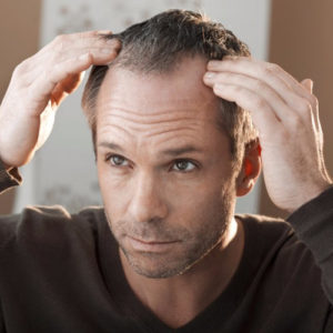 Chirurgie-de-la-calvitie