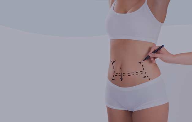 Abdominoplasty-dr-kotti