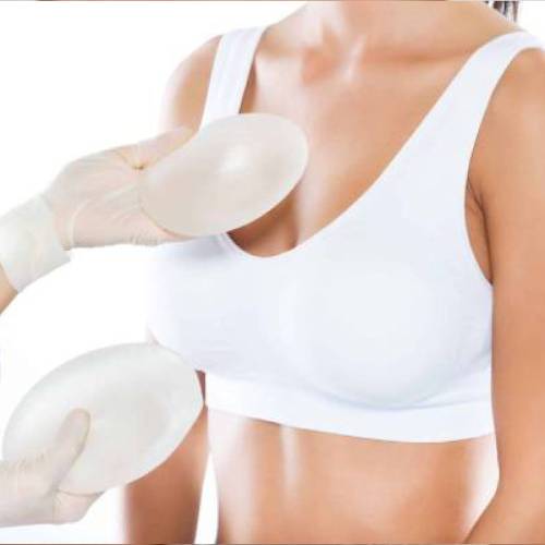 Breast lift