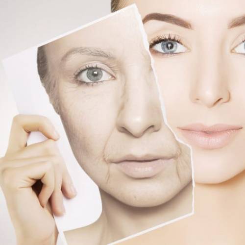 Cervico-facial lifting and facial rejuvenation