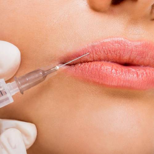 Injections and filling