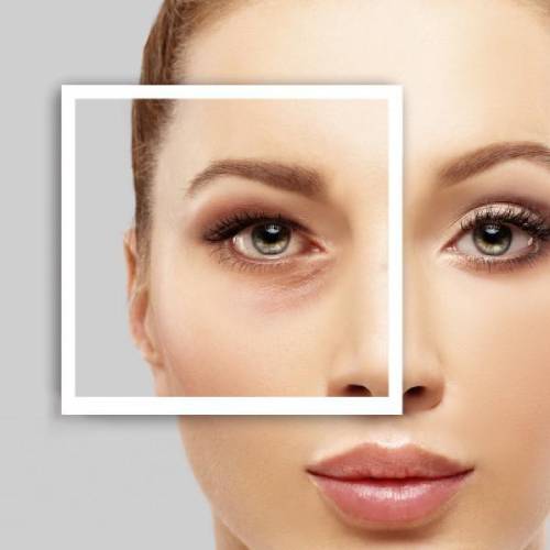 Medical profiloplasty