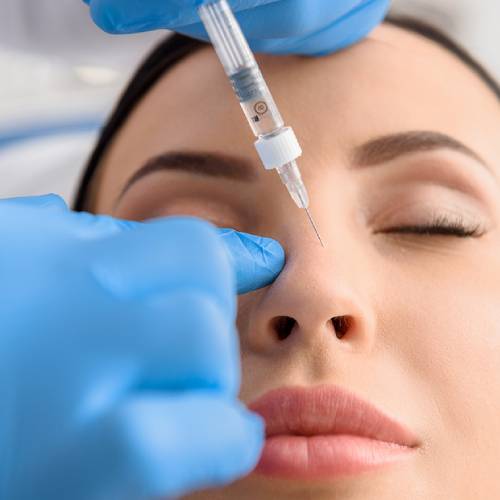 Medical rhinoplasty