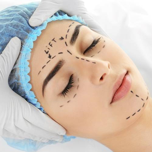 Surgical profiloplasty